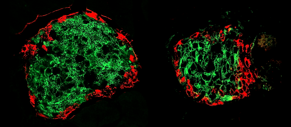 Quando il diabete inizia a svilupparsi nell'individuo prima che i sintomi siano ancora visibili una parte delle cellule beta del pancreas (in verde) scompare (a destra) rispetto ad un individuo sano (a sinistra). Immagine UNIGE, Laboratoire du Prof. Pierre Maechler. 