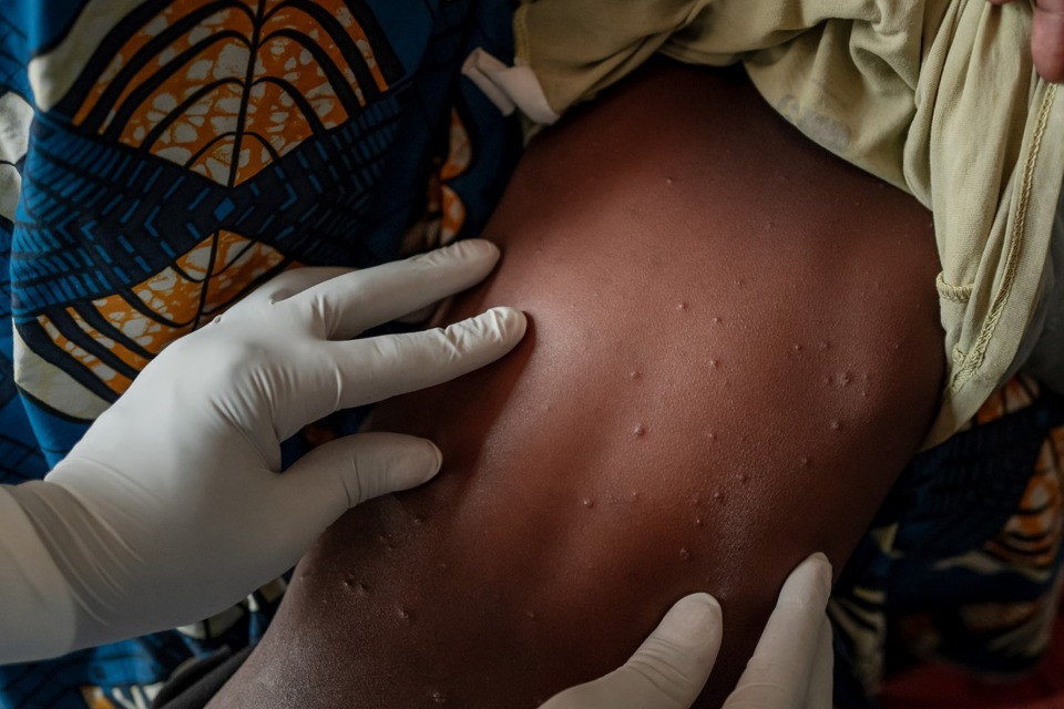 Immagine OMS (generica)