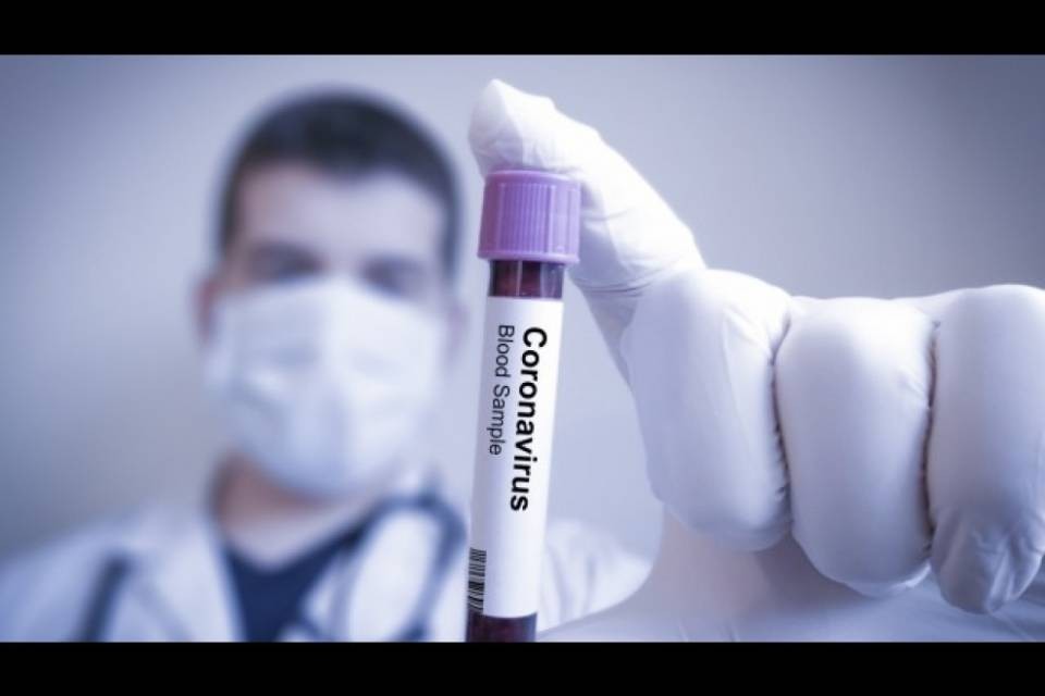 Covid-19, in Italia 482 vittime in più, calano gli "intubati"