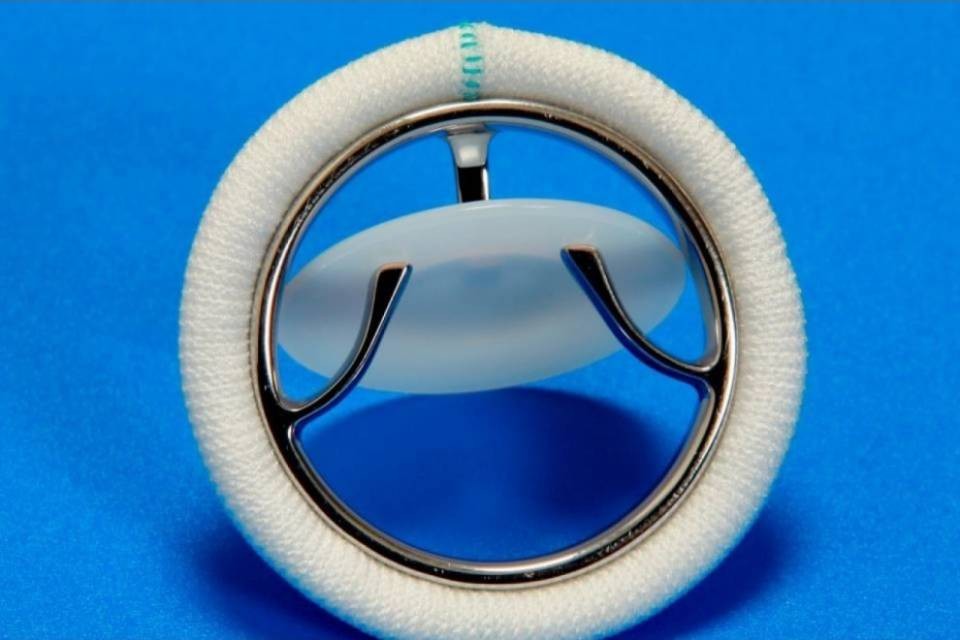 L'ETH sviluppa valvole cardiache realizzate con la stampante 3D
