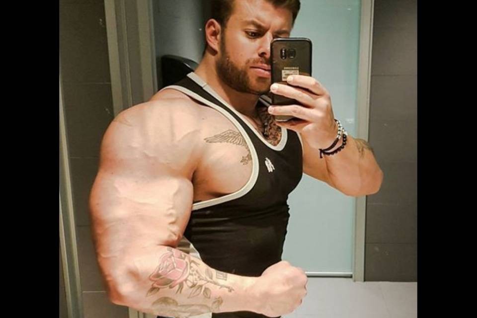 Bodybuilder stacca l'orecchio ad un tassista