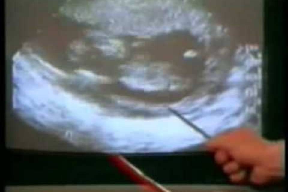 Consegnata petizione su ripercussioni negative dell'aborto