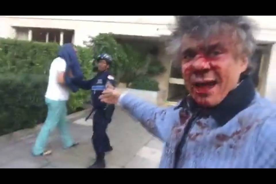 Violenta aggressione ai danni di Rachid Nekkaz