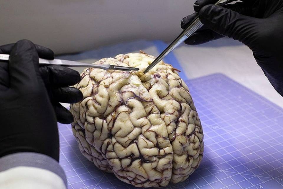 "Una proteina ha reso unico il cervello umano"