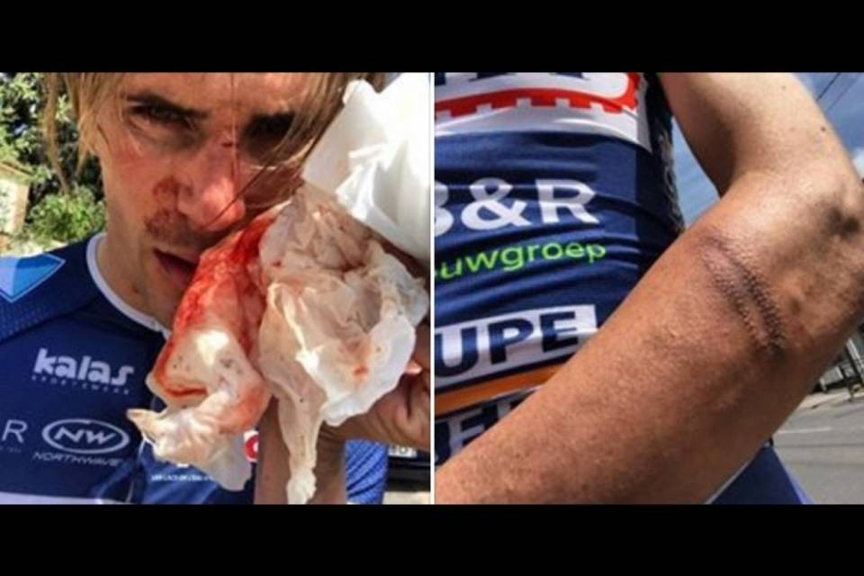 Ciclista aggredito con la mazza da baseball