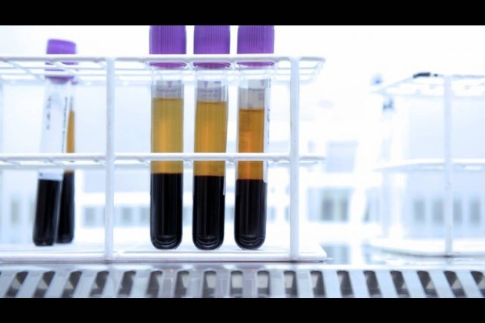 Test HIV fai da te: forse in Svizzera dall'estate