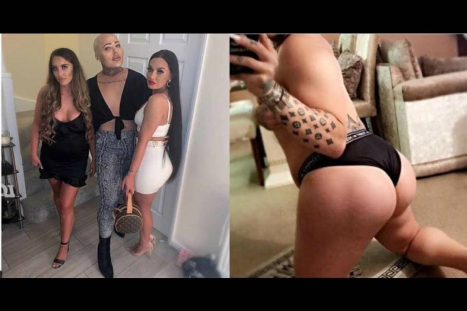 Ragazzo vuole il lato B della Kardashian: l'operazione finisce malissimo