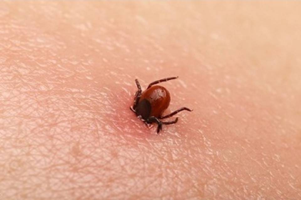Forte aumento di meningoencefalite da zecca