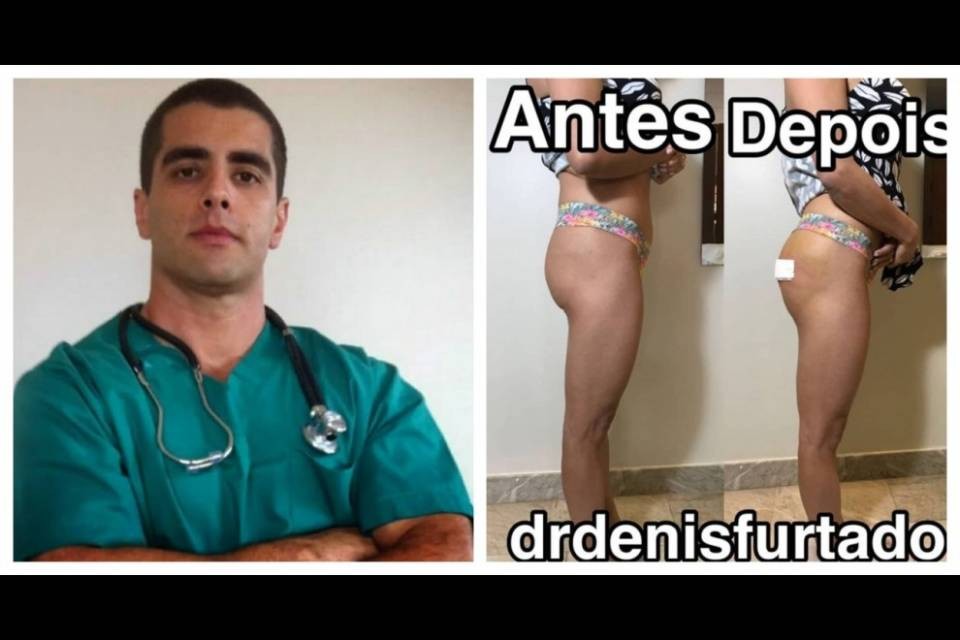 Il caso del dottor Bumbum, da star del lato B a ricercato