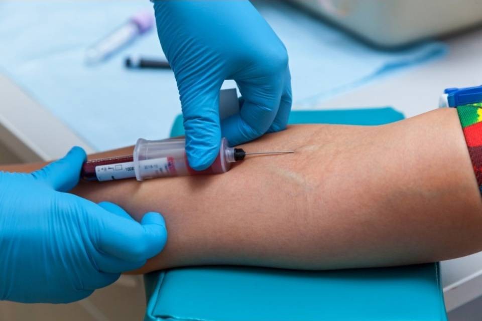“Bisogna capire quali sono le performance di questi test”