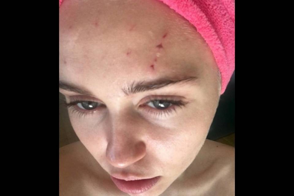 Miley, stavolta non graffiante, ma graffiata