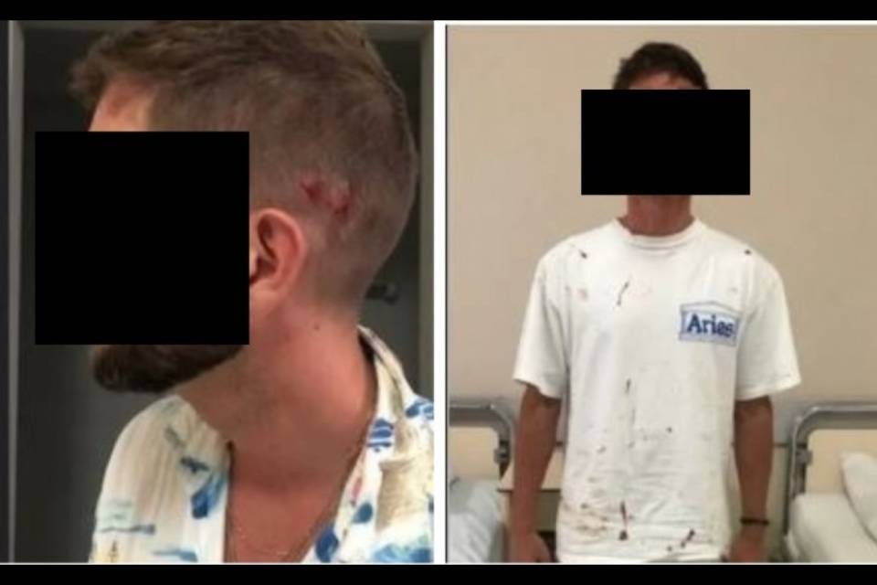 Coppia gay pestata a sangue a Mykonos