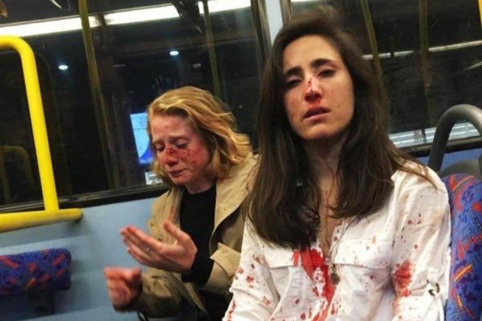 Si rifiutano di baciarsi e vengono pestate a sangue